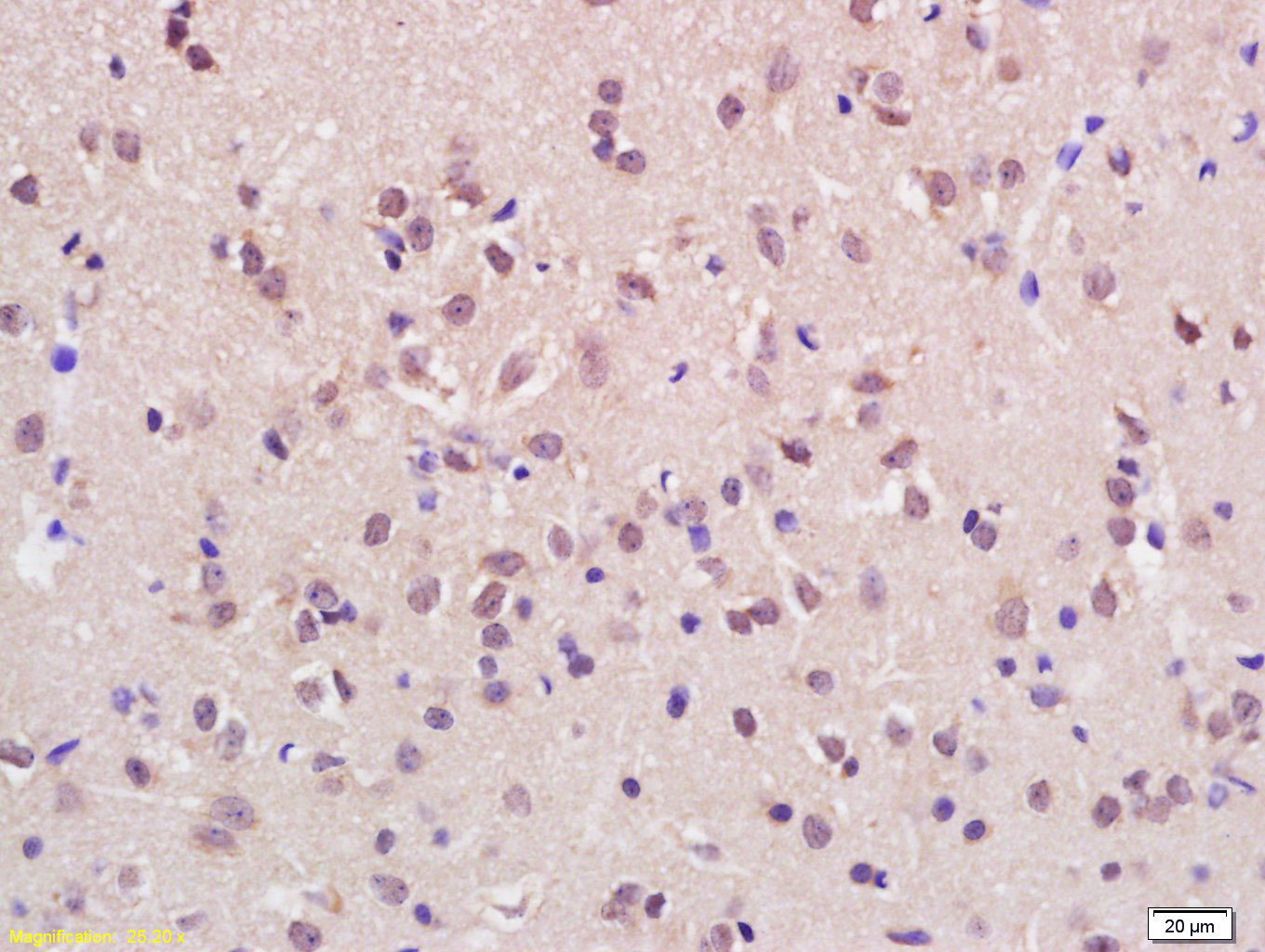 ASH1L Rabbit pAb(bs-11866R)-50