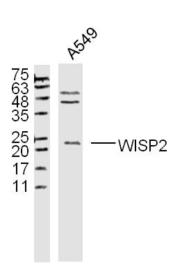 WISP2 Rabbit pAb(bs-5100R)-50u