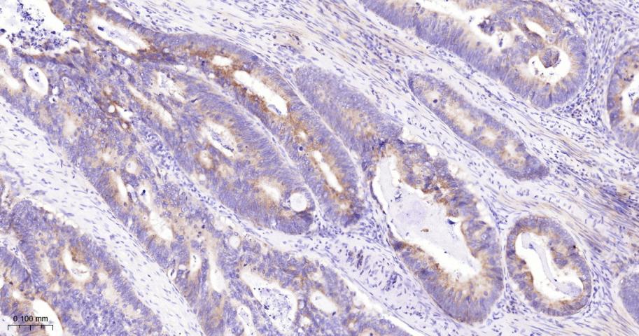 EIF2S1 Recombinant Rabbit mAb(