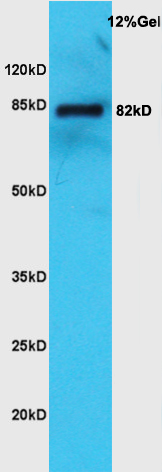 KCNN3 Rabbit pAb(bs-11569R)-50