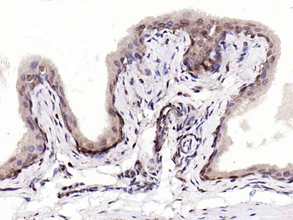 S100A4 Rabbit pAb(bs-3759R)-50