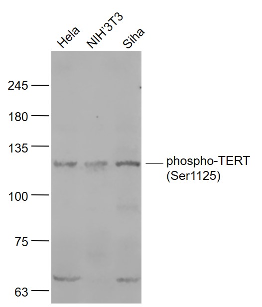 phospho-TERT (Ser1125) Rabbit 