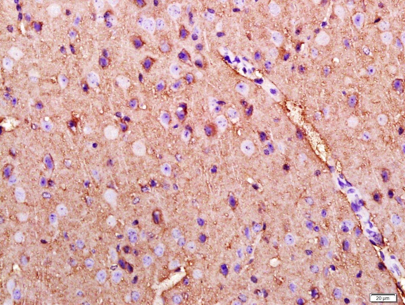 GPM6A Rabbit pAb(bs-10757R)-50