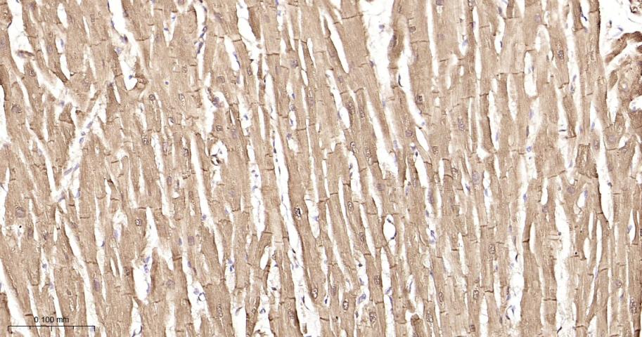 Hsp27 Recombinant Rabbit mAb(b