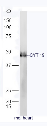 CYT 19 Rabbit pAb(bs-10633R)-5