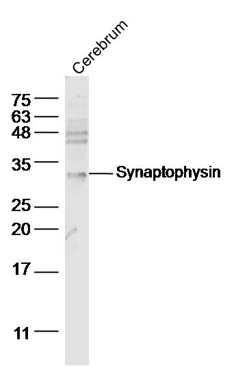 Synaptophysin Rabbit pAb(bs-88