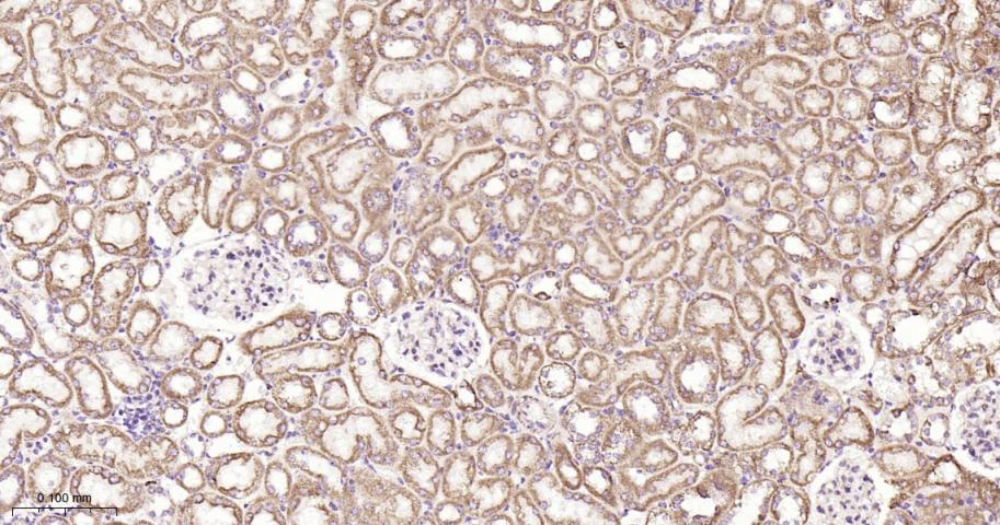 SDHB Recombinant Rabbit mAb(bs