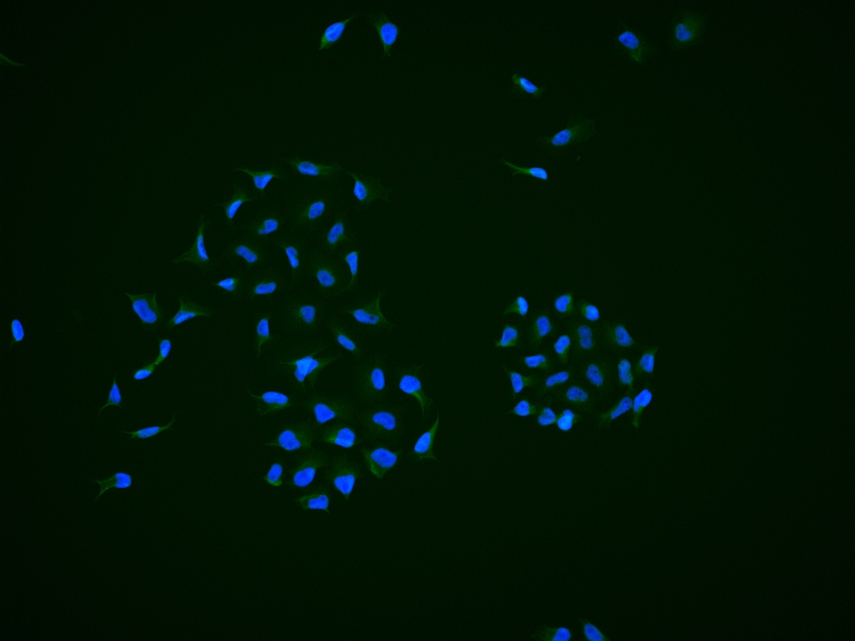LATS1 Rabbit pAb(bs-2904R)-50u