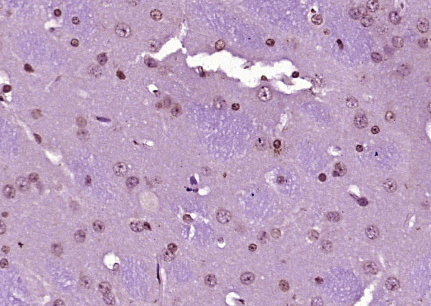 AMPK beta 1/PRKAB1 Rabbit pAb(