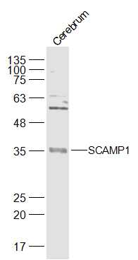 SCAMP1 Rabbit pAb(bs-17261R)-5