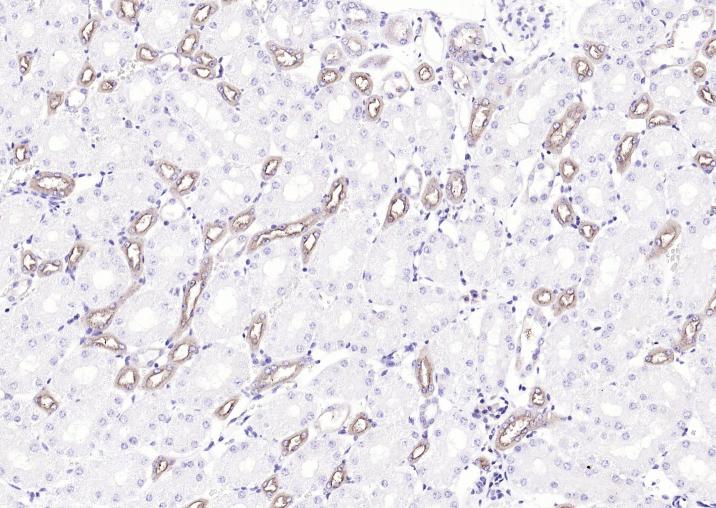 UMOD Rabbit pAb(bs-2189R)-50ul