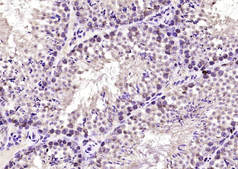 THRA1+2 Rabbit pAb(bs-6222R)-5