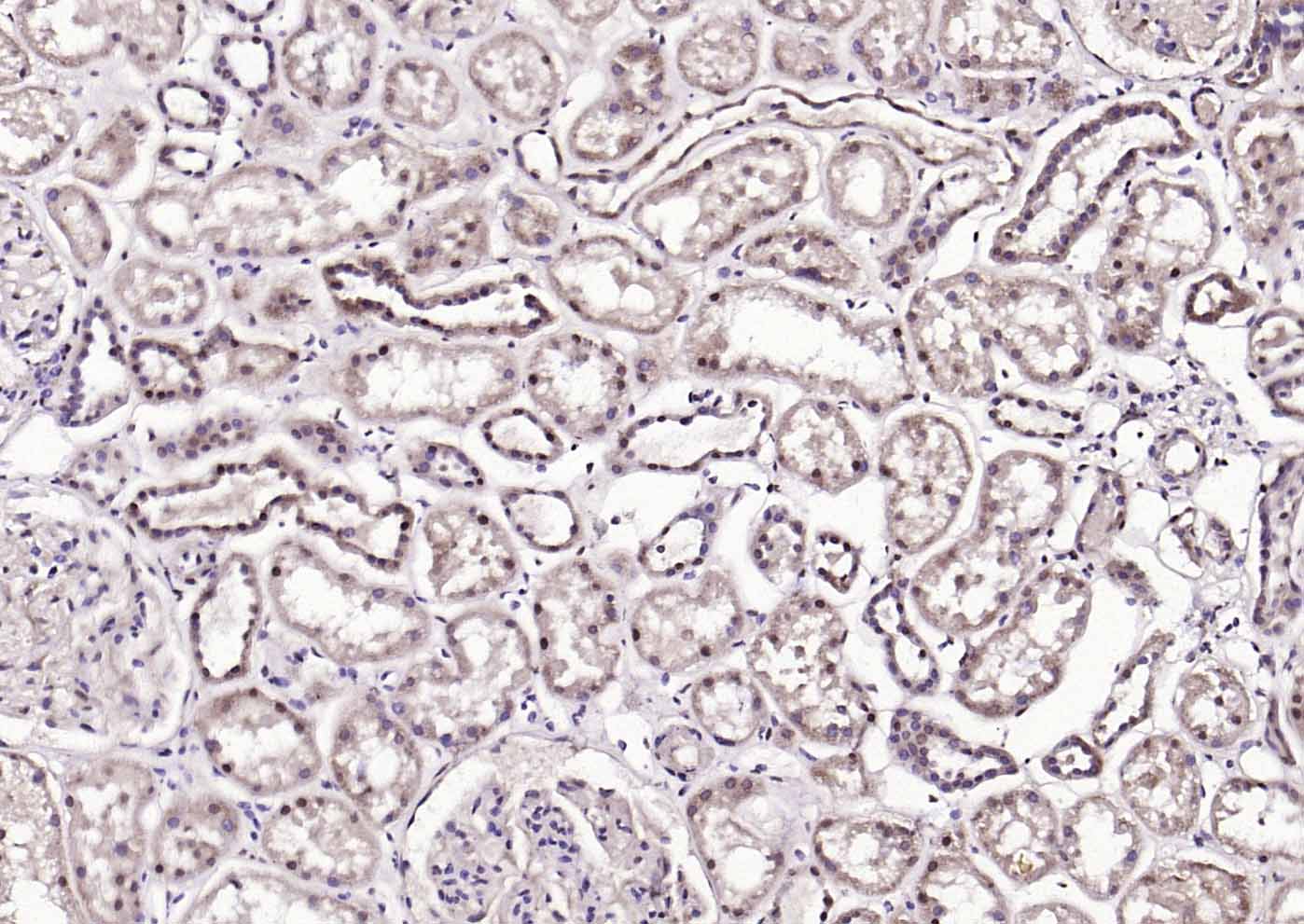 AMPK beta 1/PRKAB1 Rabbit pAb(