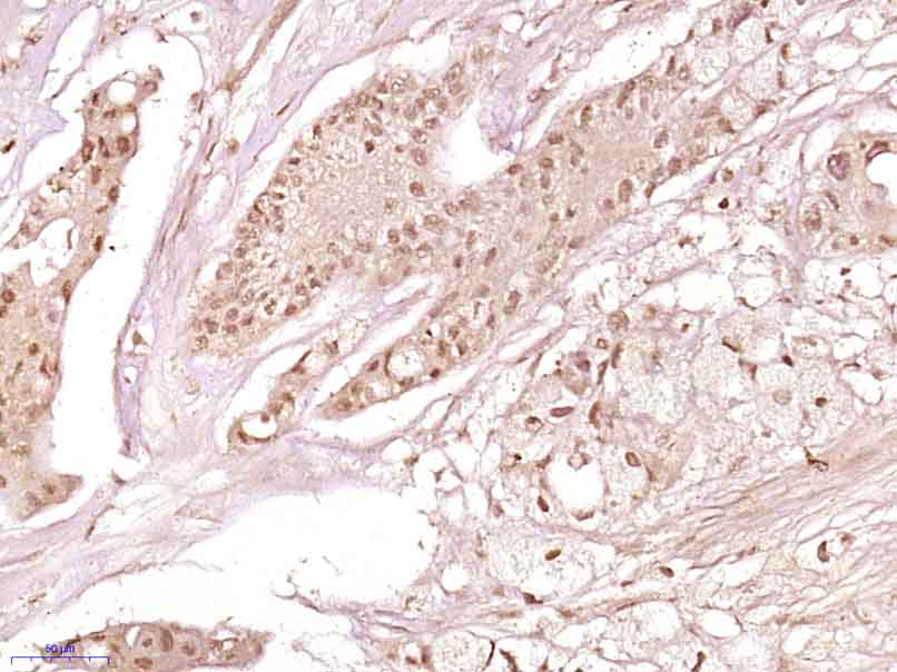 ZNF860 Rabbit pAb(bs-16433R)-5