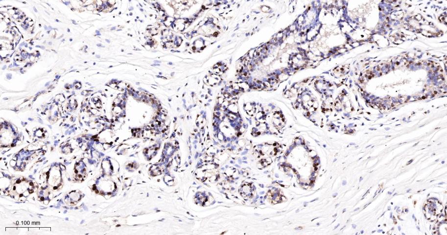 Ku80 Recombinant Rabbit mAb(bs