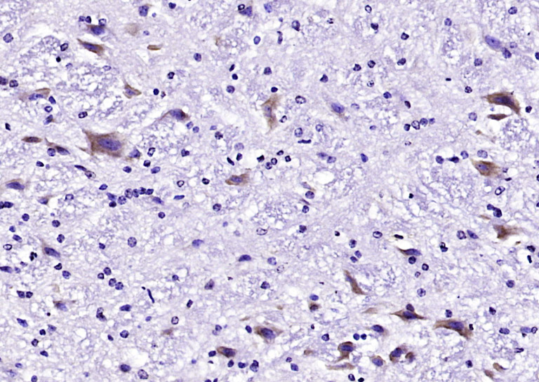 Tuberin Rabbit pAb(bs-3586R)-5