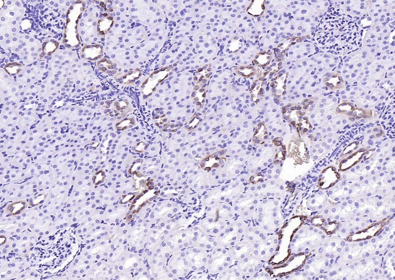 Angiotensin II type 1A recepto