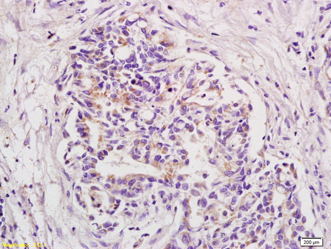 BOD1 Rabbit pAb(bs-6900R)-50ul