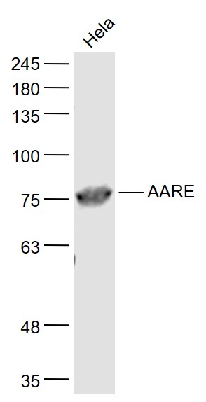 AARE Rabbit pAb(bs-5983R)-50ul