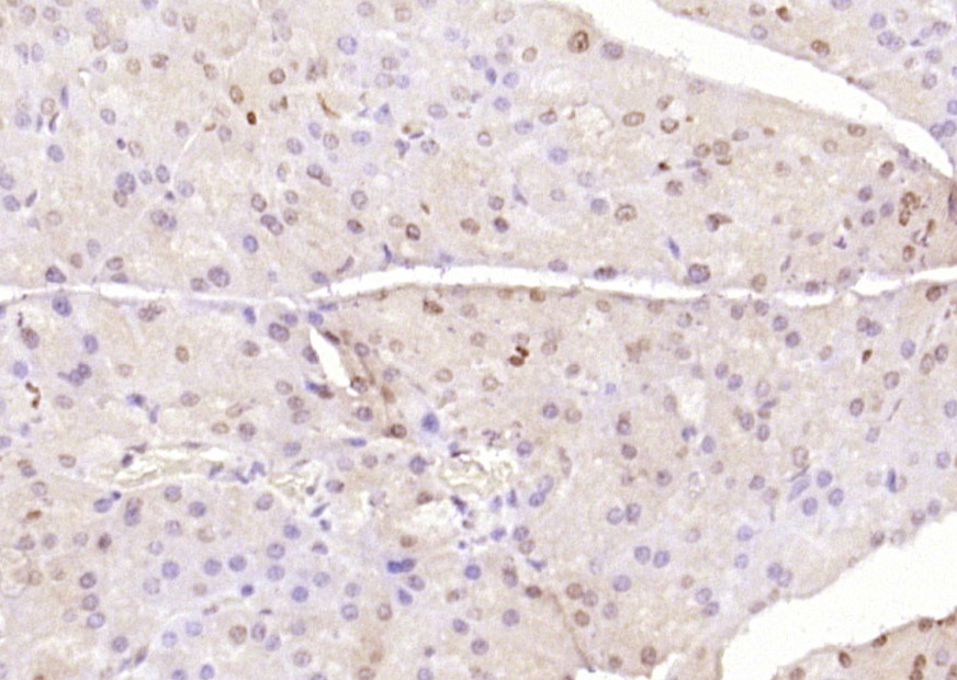 PTF1A Rabbit pAb(bs-11930R)-50