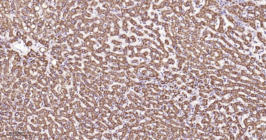 SDHB Recombinant Rabbit mAb(bs