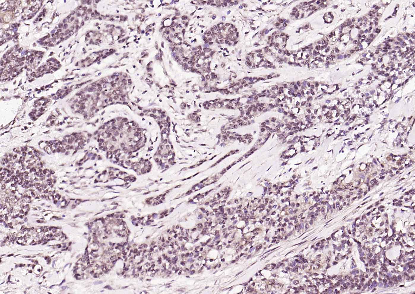 AMPK beta 1/PRKAB1 Rabbit pAb(