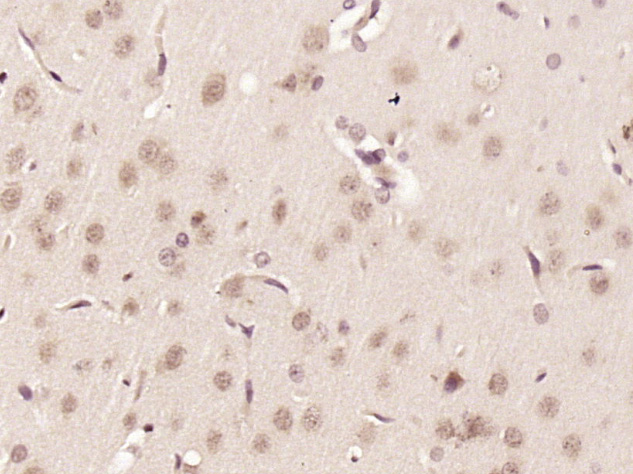 KIAA0355 Rabbit pAb(bs-16971R)