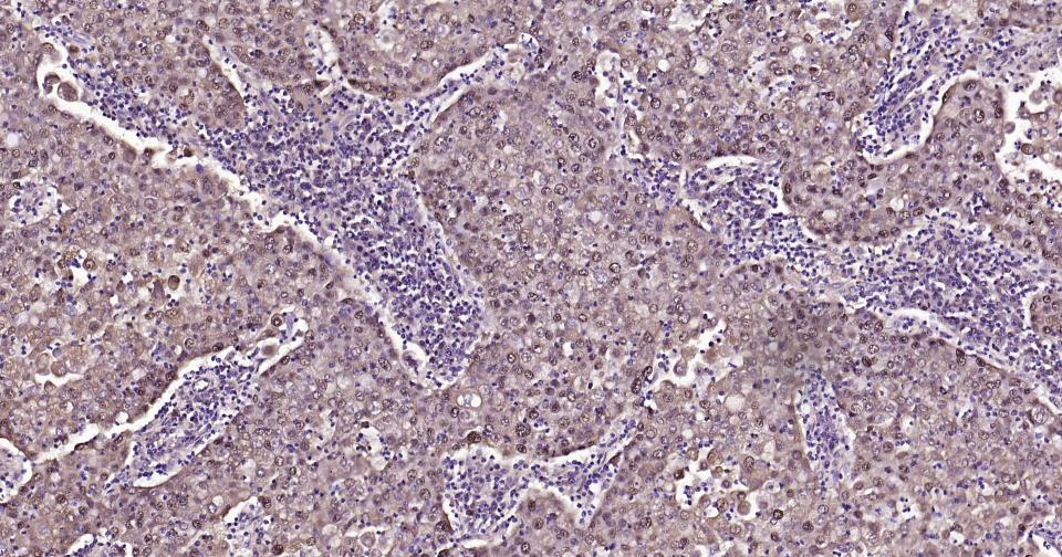 SNAI1 Rabbit pAb(bs-1371R)-50u