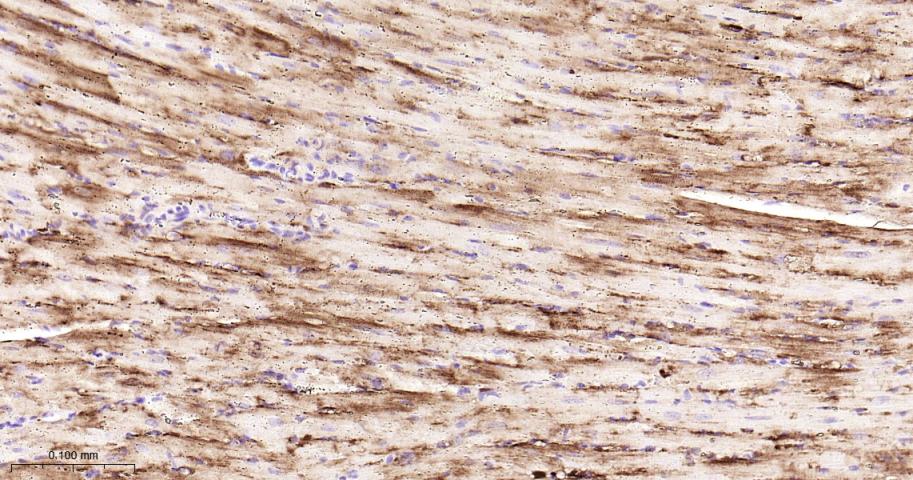 Hsp27 Recombinant Rabbit mAb(b