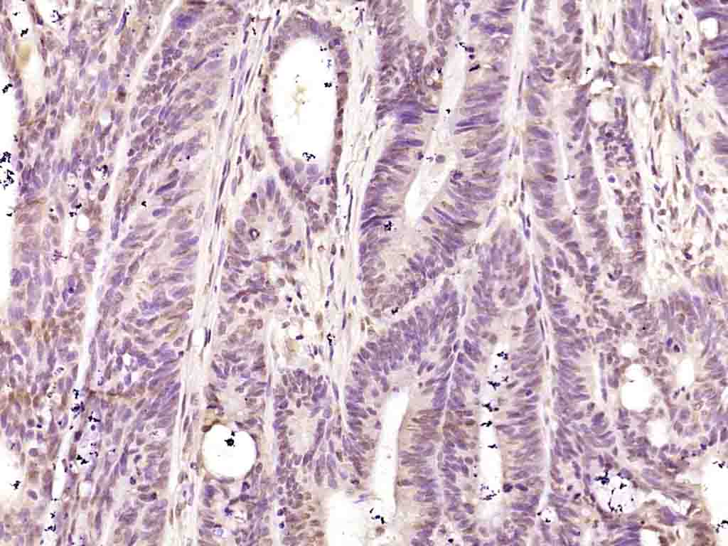 hnRNP K Rabbit pAb(bs-4296R)-5