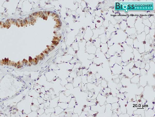SFTPA1 Rabbit pAb(bs-0770R)-50