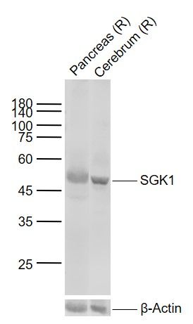 SGK1 Rabbit pAb(bs-4904R)-50ul