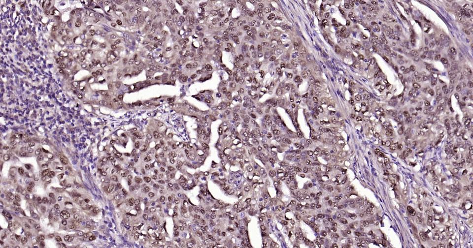 SNAI1 Rabbit pAb(bs-1371R)-50u