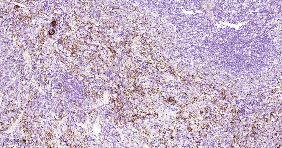 ITGB3 Recombinant Rabbit mAb(b