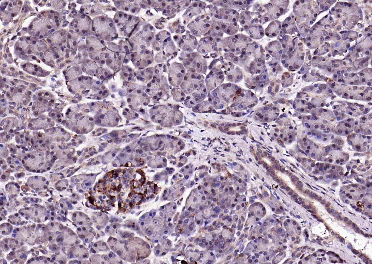 KLK1 Rabbit pAb(bs-1963R)-50ul