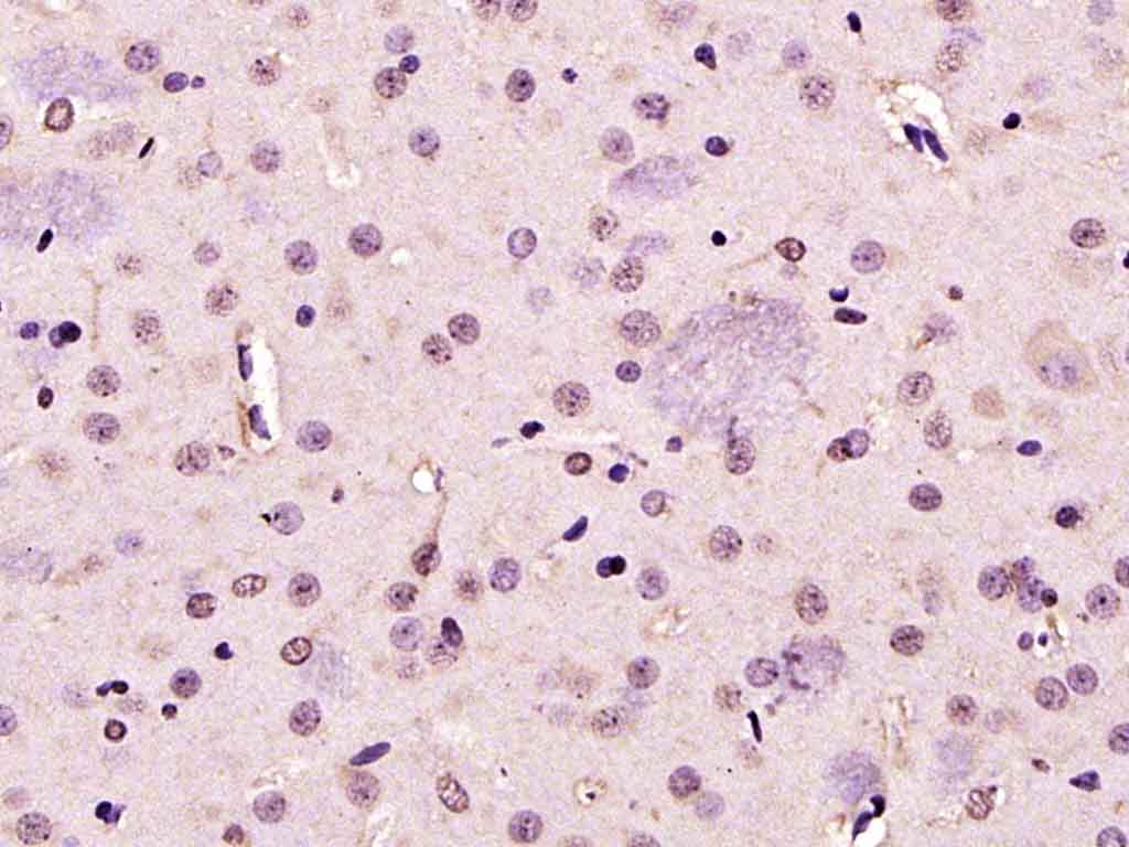 PARK7/DJ1 Rabbit pAb(bs-1306R)