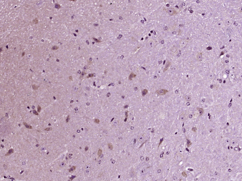 KATNA1 Rabbit pAb(bs-9308R)-50