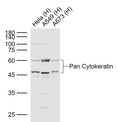 Pan Cytokeratin Rabbit pAb(bs-