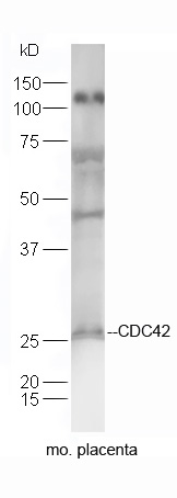 CDC42 Rabbit pAb(bs-3555R)-50u