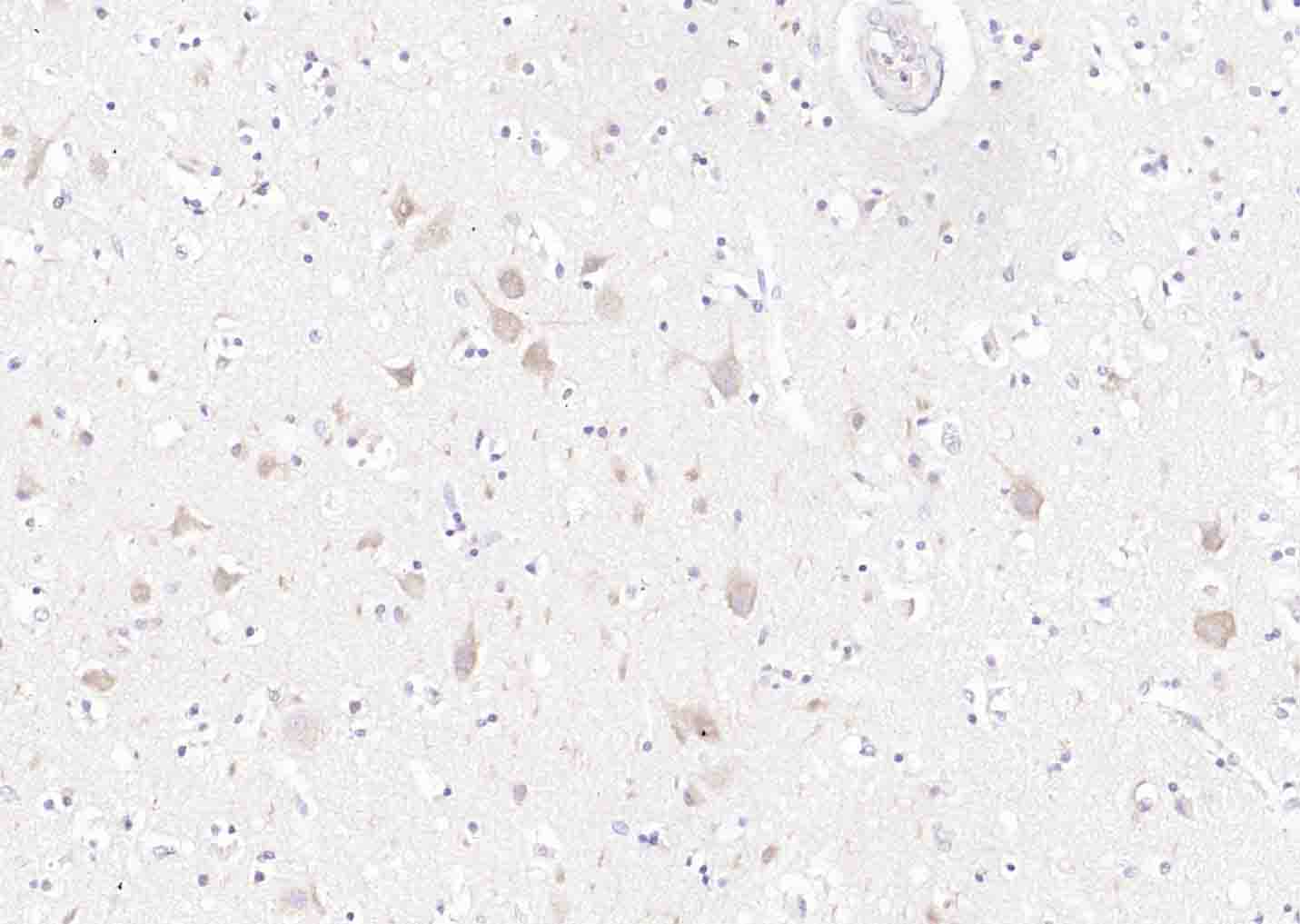 Synaptophysin Rabbit pAb(bs-88