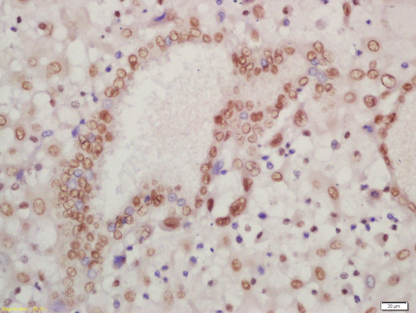 HOXA13 Rabbit pAb(bs-12244R)-5