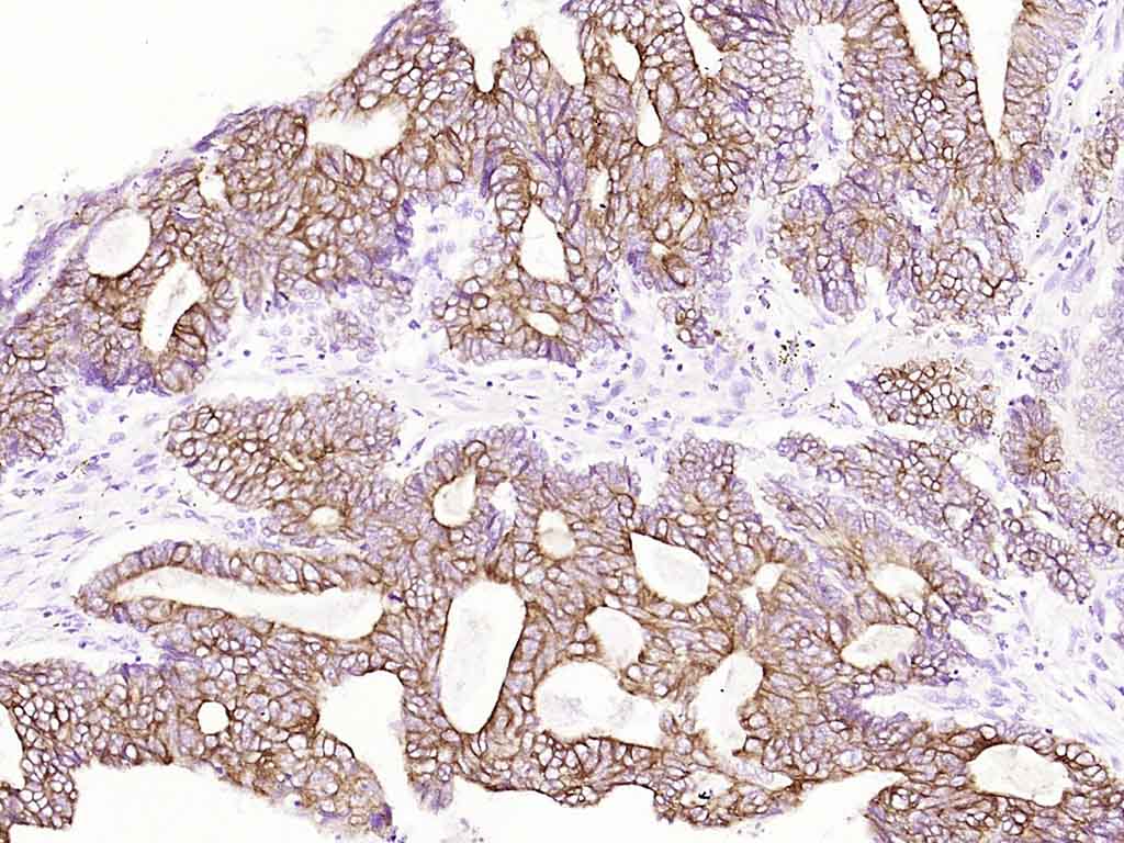 Cytokeratin 8(Ready to use) Mo