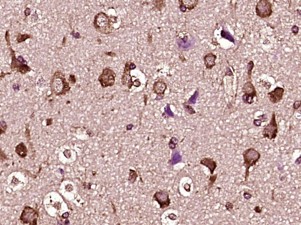 GRP94 Rabbit pAb(bs-0194R)-50u