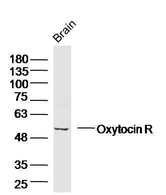 Oxytocin R Rabbit pAb(bs-1314R