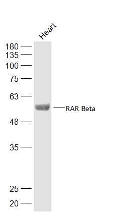 RARB Rabbit pAb(bs-0516R)-50ul