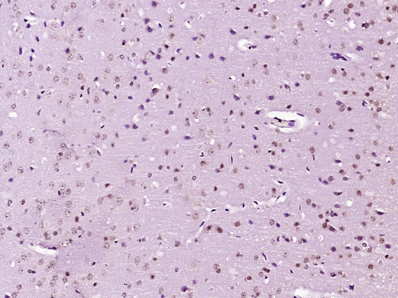 phospho-APBB1 (Ser347) Rabbit 