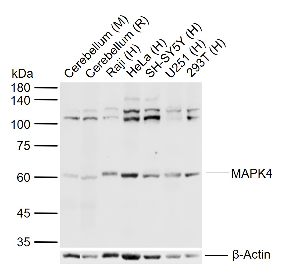 MAPK4 Rabbit pAb(bs-4131R)-50u