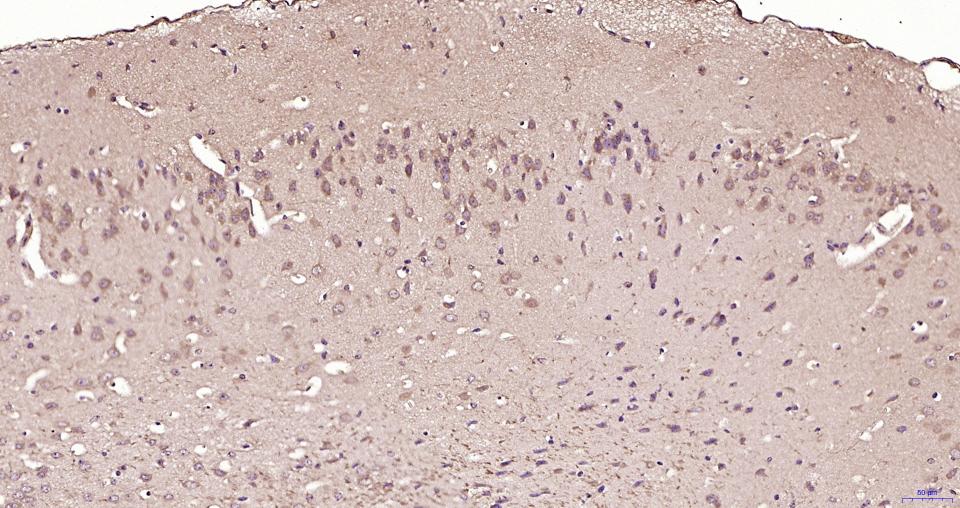 TBK1 Rabbit pAb(bs-7497R)-50ul