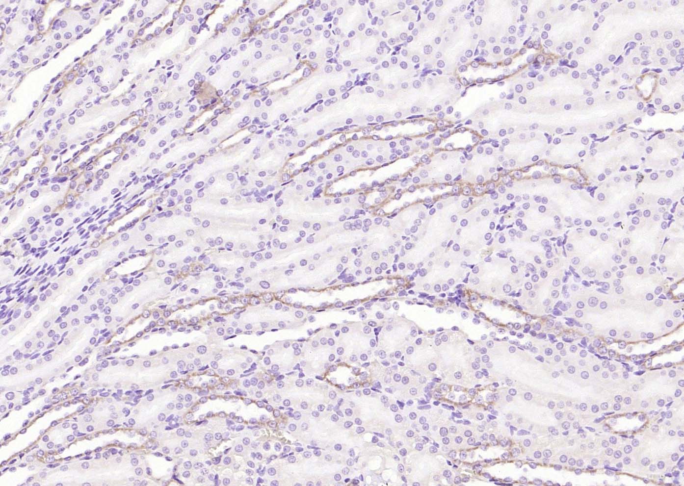 Angiotensin II Type 1 Receptor