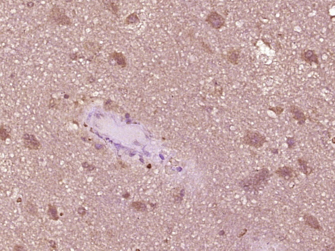 phospho-IRF3 (Ser386) Rabbit p